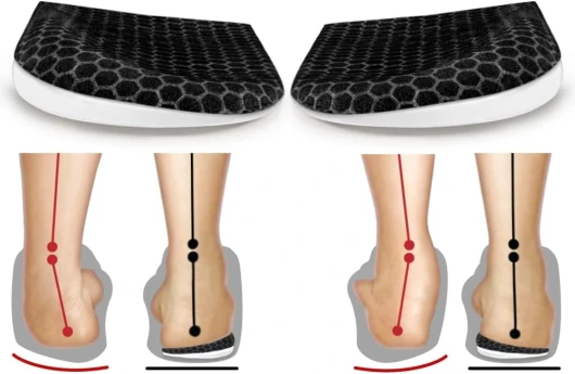 BIGGCOOL Corrective Insoles for Supination & Over-Pronation, Orthotics Medial & Lateral Heel Wedge Inserts for Foot Alignment, Bow Legs, Knee Pain (Black-2 Layers, L: Women 8-12/Men: 7.5-13) L: Women 8-12/Men: 7.5-13 Black-2 Layers
